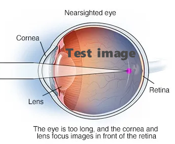 Refractify - Virtual Optical Layer